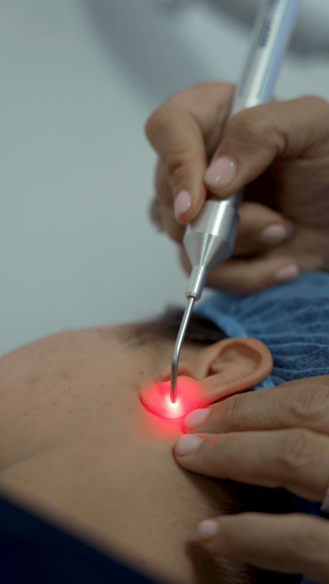 Le faisceau rouge du laser posé sur un point de l’oreille